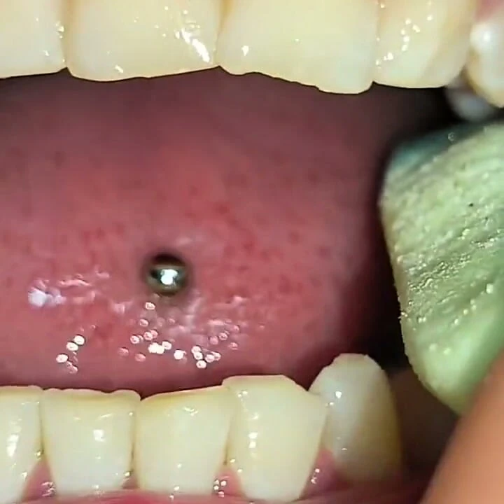 Snake Gum