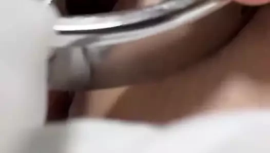 Açık amcık
