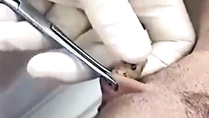 mujer que va a que la pongan un pirsing en su pussy