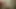 Stairpost sikme çift anal fisting göbek bulge hkj kinkyniky