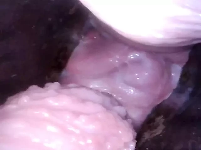 vajina endoskop