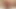 seksi aşırı anal porno sindy gül fisting onu göt &amp; prolapsusu