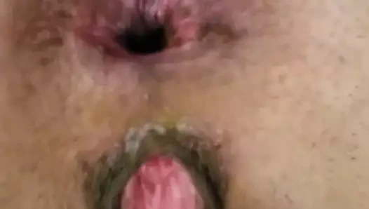 Fleshly fucked pussy and asshole