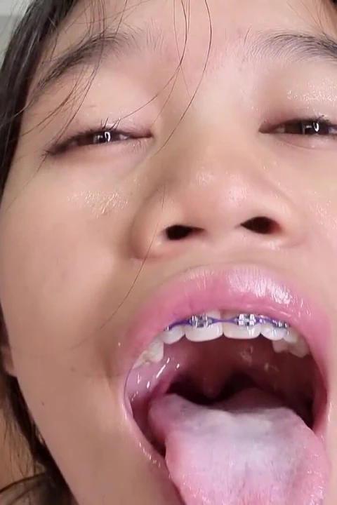 Gfe Plansız Hamilelik