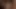 anal