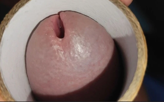 Glans penisini sıvı yapıştırıcı ile keskinleştirme.