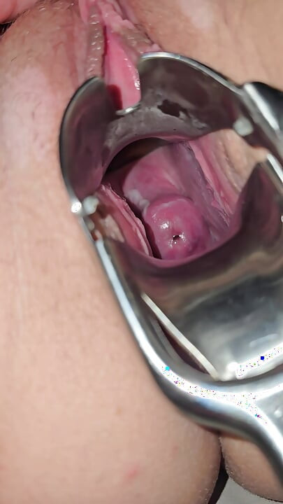 Orta yaşlı seksi kadın amını teftiş ediyor ve içine görmek için spekulum sokuyor