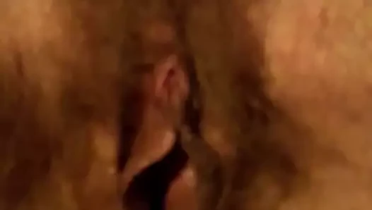 Kıllı amcık