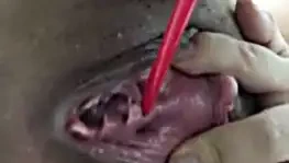 üretra mastürbasyon