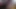 [karmica][röntgenci] Yarağımı çekiyorum ve kocamın testislerini okşuyor (xvideos red'de 2. bölüm) karmica röntgenci kocamınkileri çekiyorum