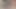 Yüksek Topuklu Ayak Yürütme ve Daha Fazlası