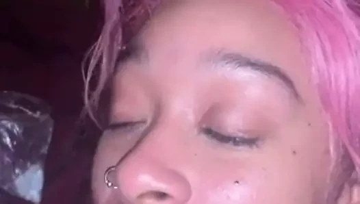 Yüzündeki fındık