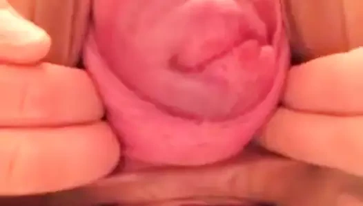 Japon sürtük - am ve eşek prolapsusu