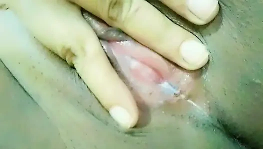 Vajina amcık deliğinden beyaz akıntı