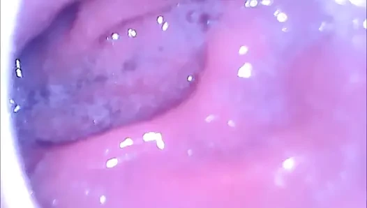 Götümün içindeki endoskop kamera