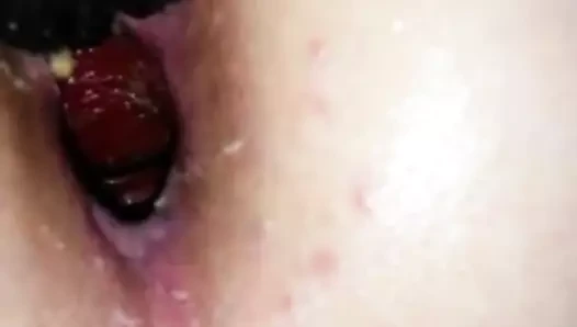 1 Hand Anal Fisting Gaping Asshole