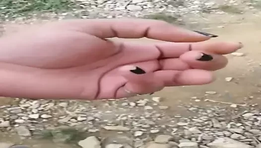 eksik parmak