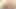 Problemler Üniversitesi - (pt 45) - dreamnow