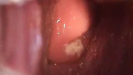 Avril pussy speculum