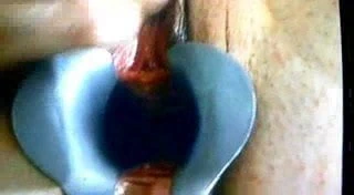 Çılgın jinekolog bölüm 1