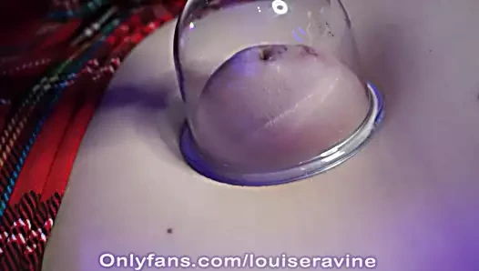 Outie göbek deliği iki kez emilerek işkence gördü