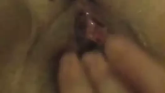 Büyük fışkırtma