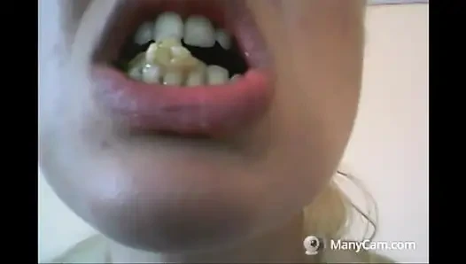 Chantal'ın dişleri çürümüş ve siyah dökülüyor