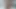 Ağrılı Ayaklarımı Seviyorum