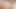 Utangaç eş Enhance2