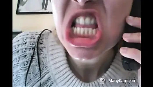 Chantal'ın dişleri çürümüş ve siyah dökülüyor