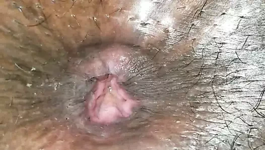 Wife's Permanently Loose Asshole