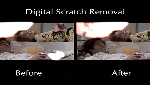 Restorasyon karşılaştırması - mkx