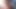 Teaser