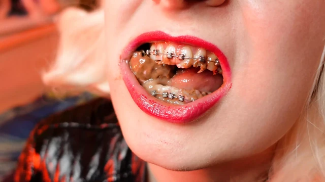 Asmr mukbang yemek fetişi diş telleri ile video yeme fetişi