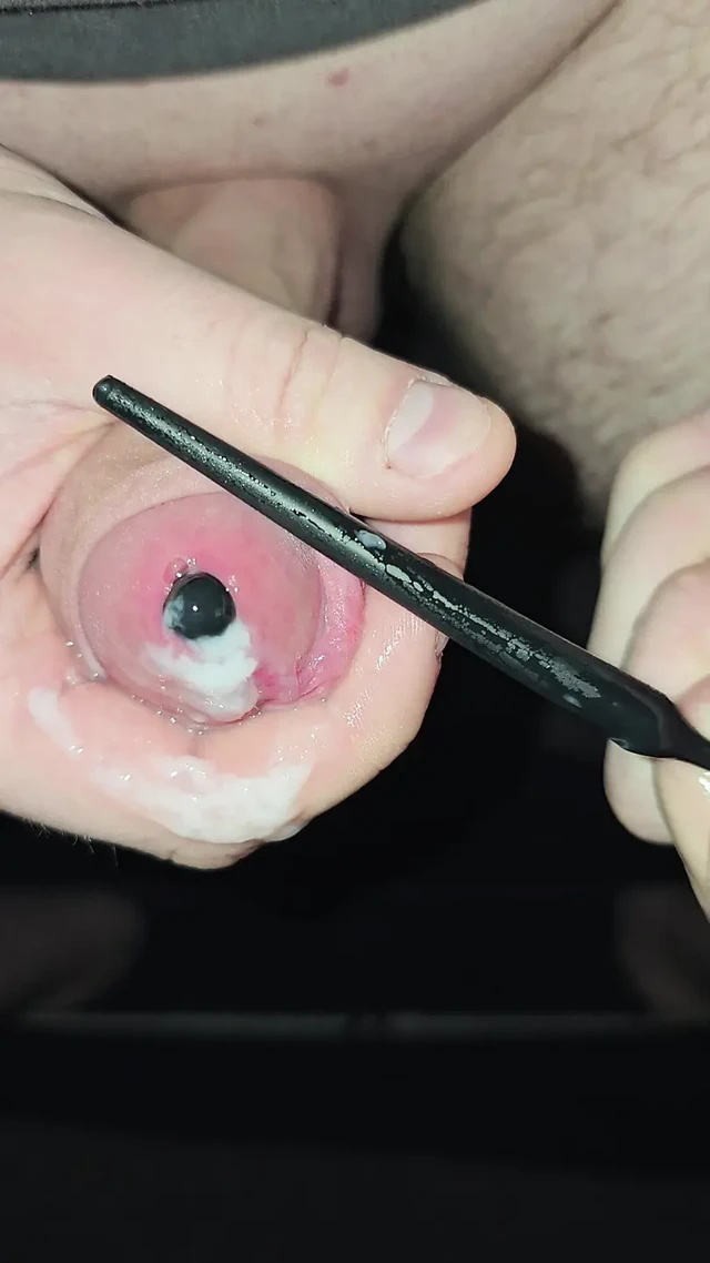 Üretramda farklı tıkalar