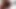 İskoç Rose Skies First Bg