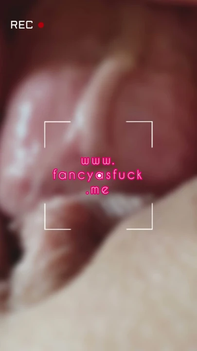 İNANILMAZ KİM BU? Süper Seksi Zayıf Dövmeli Model kaçamıyor ve doktor tarafından bacak alçısı bağlı halde sikiliyor… | Bölüm 1