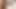 Çok küçük penis penis pompasıyla büyümeye çalışıyor