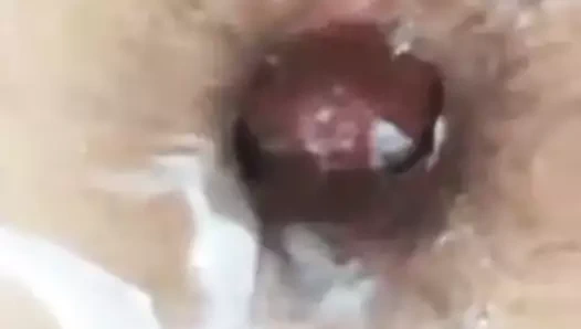 Hard fisting her asshole