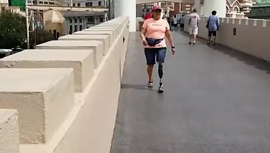 güzel olgun ampute 1