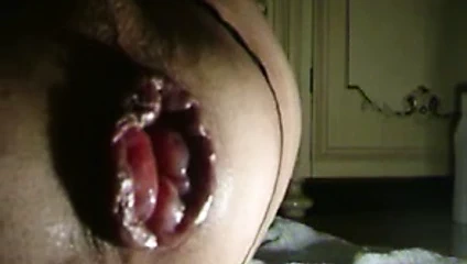 Anüsüm artık kapanmıyor ... sürekli açık kalıyor