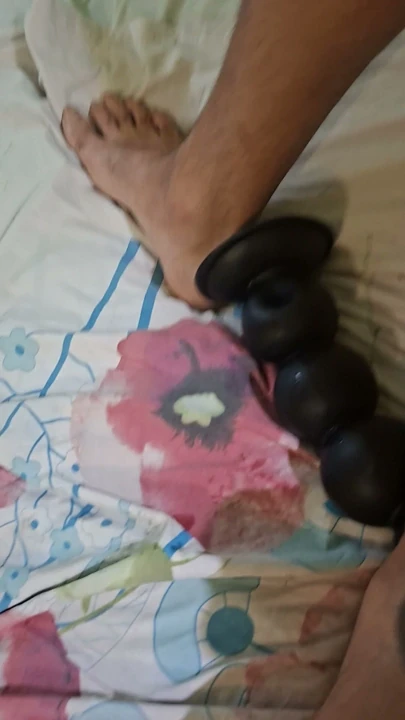 Anal taşaklar