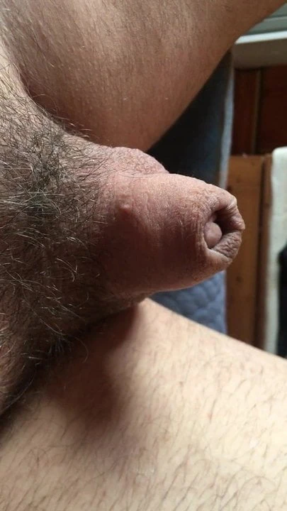 mikro penis