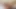 Hemşire Penny pax parmaklarıyla Brooklyn Chase'i tedavi ediyor!