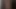 Beni duş alırken izle, iyileştiğini duydum