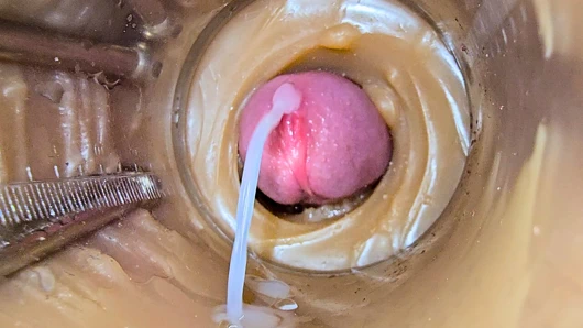 Camera Inside Deep Pussy Captures Huge Ejaculation of Sperm 2 times