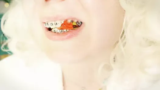 Diş teli fetişi: mukbang yemenin asmr videosu...