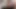 Stepmom Caught Injuired Stepson Jerking Then She Helping Him pee In Toilet
