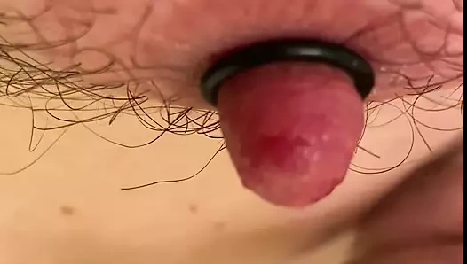 Meme ucu germe işlemi