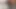 Ayak emiyor teaser